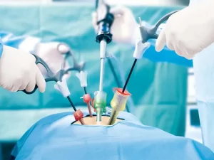 لاپاراسکوپی چیست و چگونه انجام می شود؟