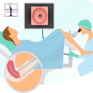 كولپوسكوپي - دكتر بيتا زلالي