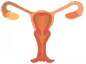 انسداد لوله فالوپ