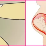 ترشحات واژن در اوایل و اواخر بارداری