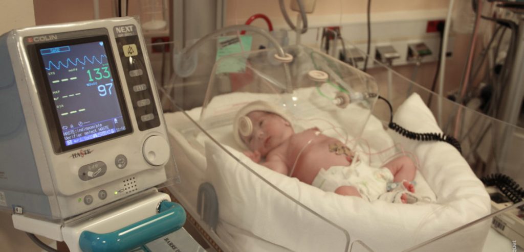 علائم زایمان زودرس