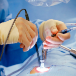 بهترین زمان بارداری بعد از عمل لاپاراسکوپی