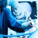 بهترین زمان انجام لاپاراسکوپی
