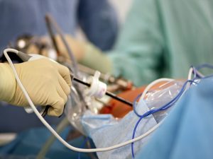 هزینه عمل لاپاراسکوپی در سال 1402