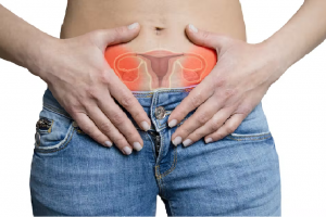 کیست درموئید تخمدان - دکتر بیتا زلالی