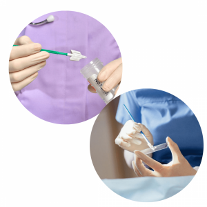 آزمایش پاپ اسمیر