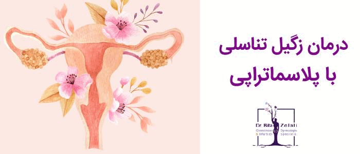 درمان زگیل تناسلی با پلاسماتراپی