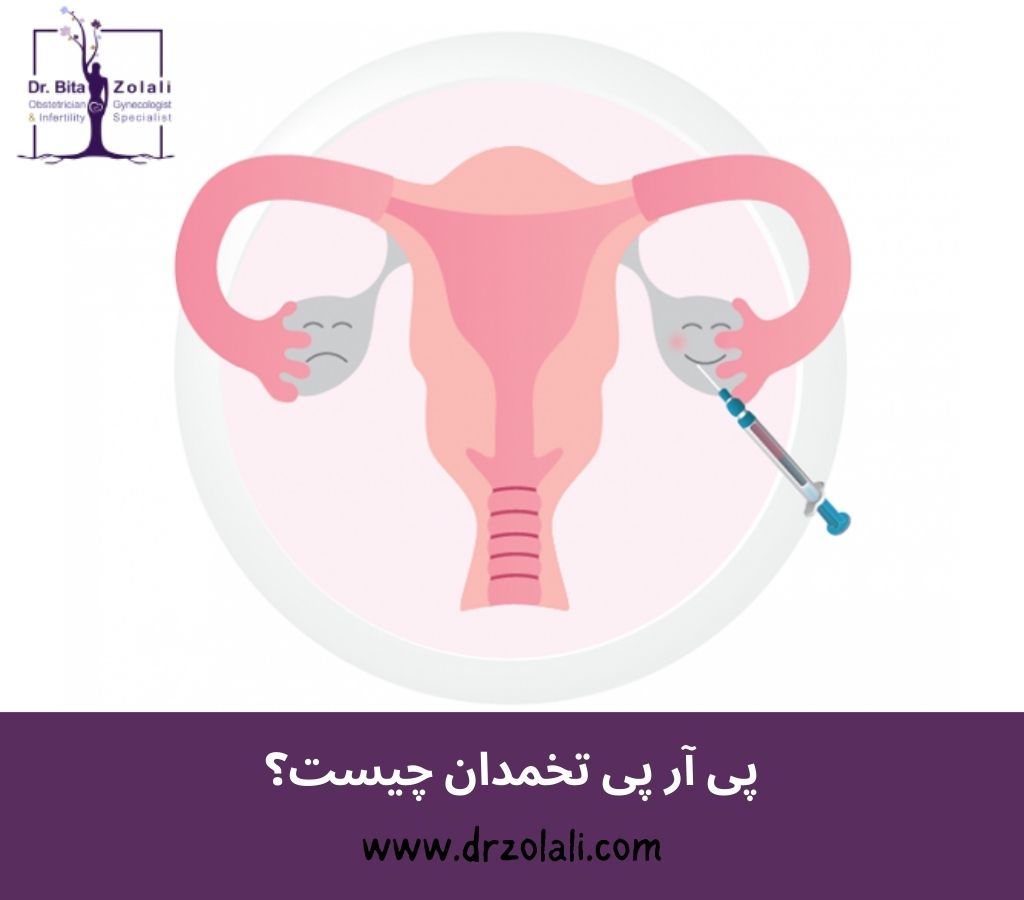 پی آر پی تخمدان چیست؟ - دکتر بیتا زلالی