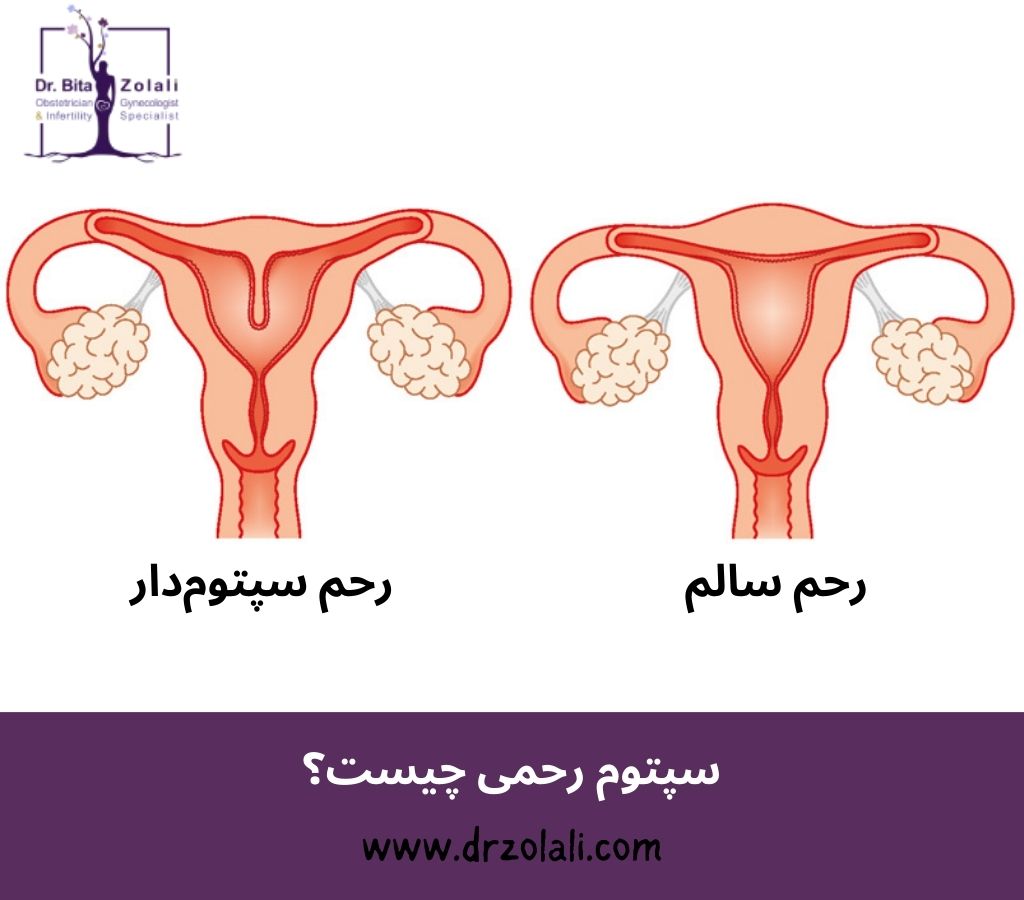 سپتوم حمی چیست؟ - دکتر بیتا زلالی