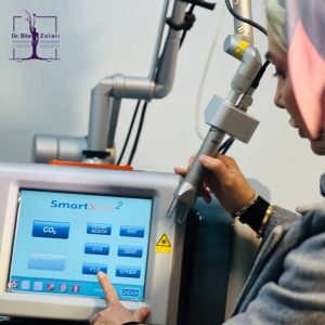 لبیاپلاستی با لیزر مونالیزا- دکتر بیتا زلالی