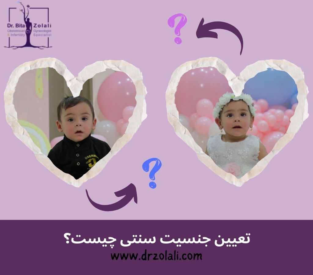 تعیین جنسیت سنتی از روی زبان - دکتر بیتا زلالی