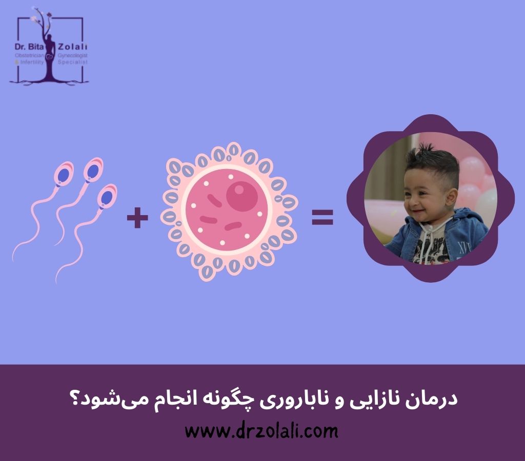 درمان نازایی و ناباروری چگونه انجام می‌شود - دکتر بیتا زلالی