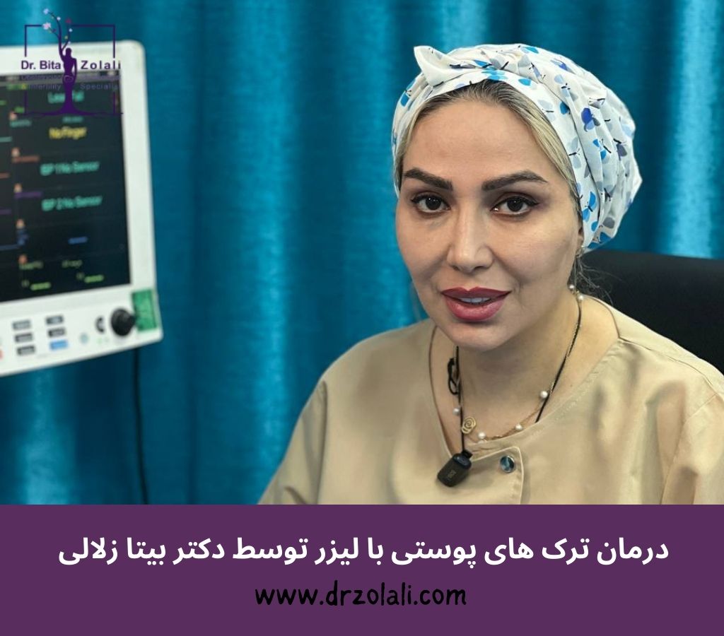 بهترین دکتر لیزر ترک های پوستی در تهران - دکتر بیتا زلالی