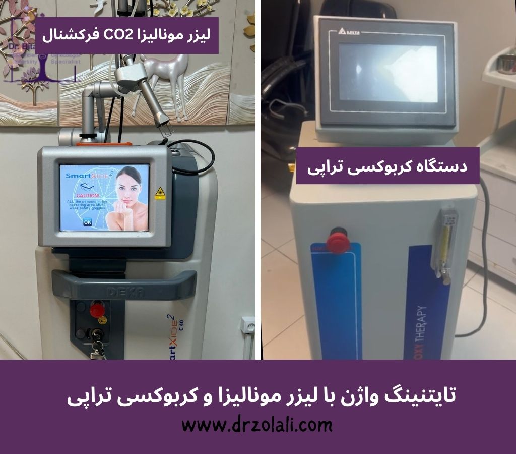 تایتنینگ واژن با لیزر و کربوکسی – دکتر بیتا زلالی تایتنینگ واژن با لیزر و کربوکسی - دکتر بیتا زلالی