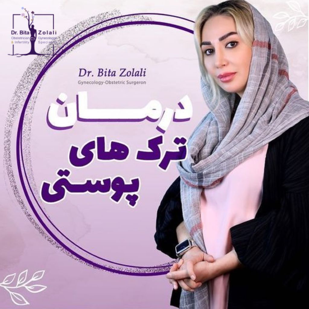 لیزر ترک های پوستی - درمان ترک های پوستی با لیزر - دکتر بیتا زلالی