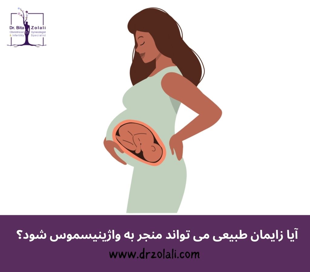 واژینیسموس و زایمان طبیعی – دکتر بیتا زلالی واژینیسموس و زایمان طبیعی - دکتر بیتا زلالی