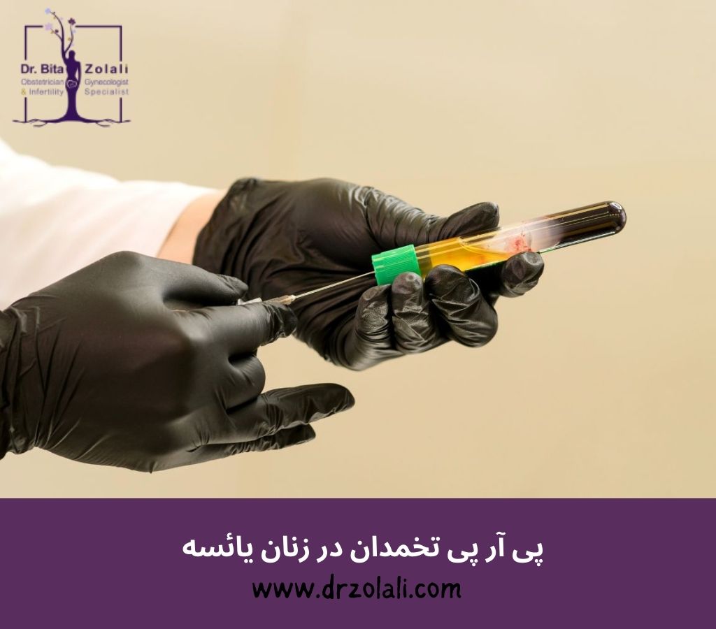 پی آر پی تخمدان در زنان یائسه - دکتر بیتا زلالی