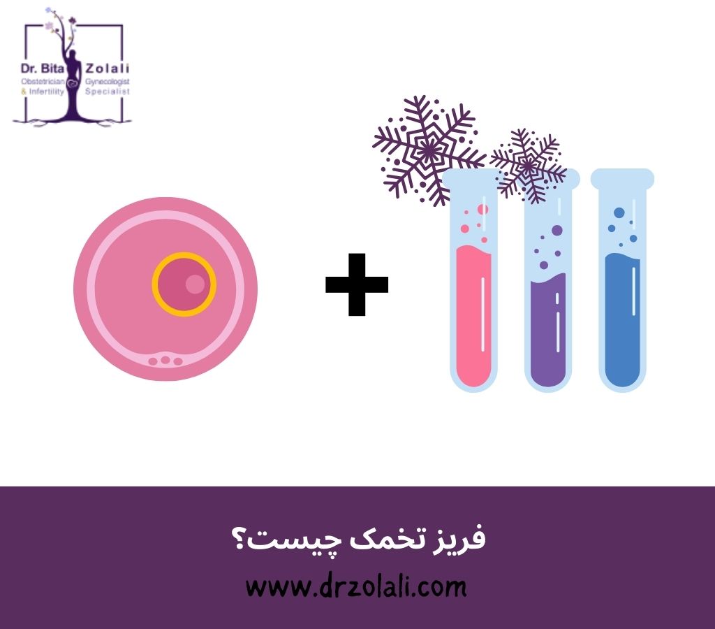 فریز تخمک چیست – دکتر بیتا زلالی فریز تخمک چیست - دکتر بیتا زلالی