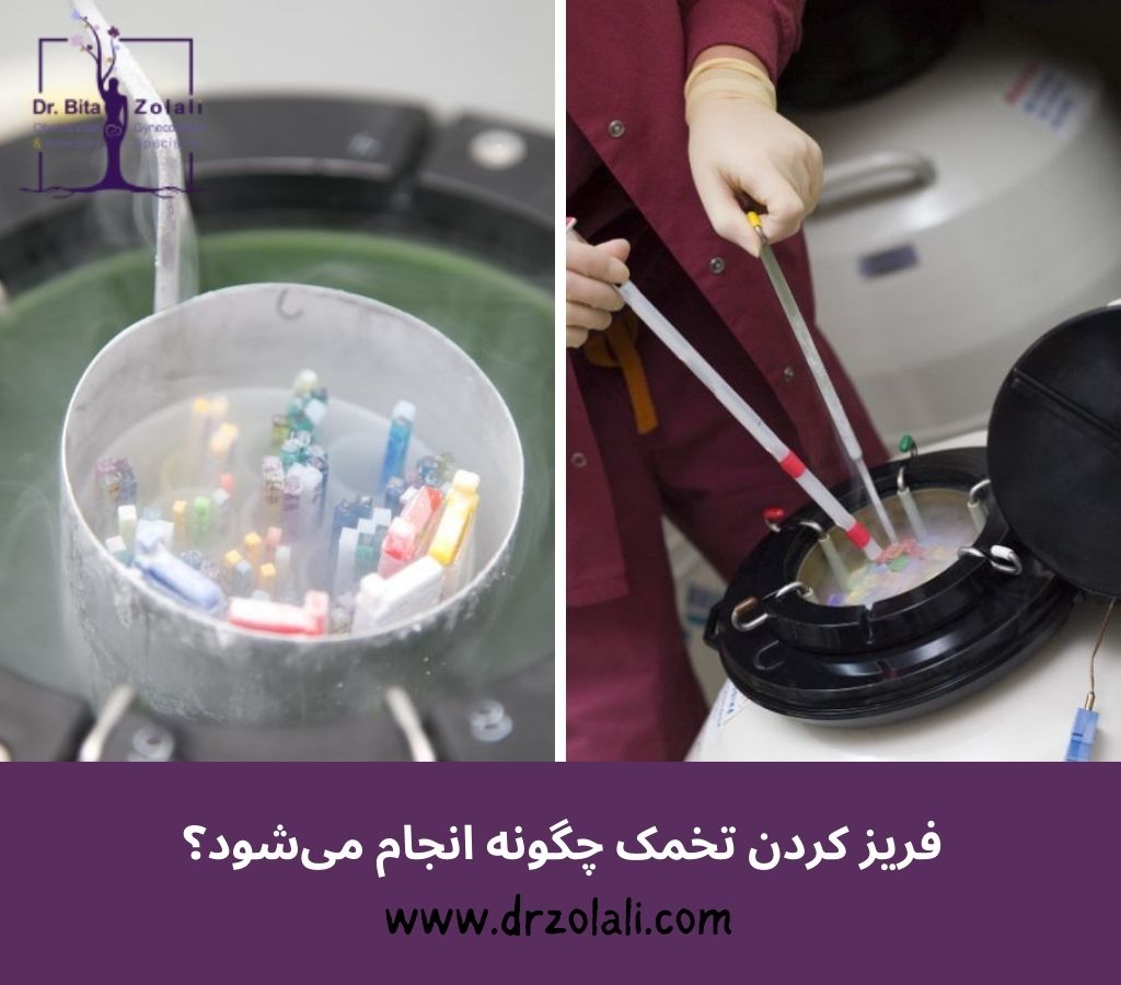 مراحل فریز تخمک – دکتر بیتا زلالی مراحل فریز تخمک - دکتر بیتا زلالی