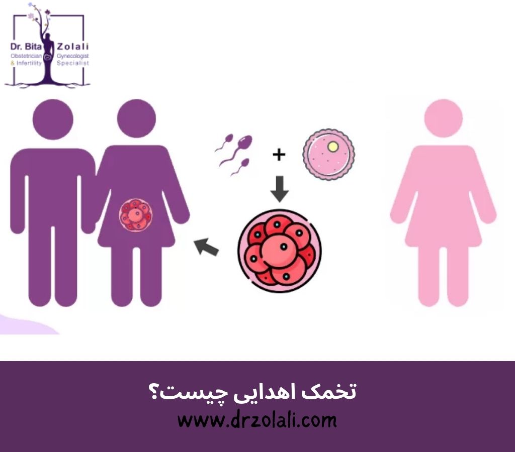 تخمک اهدایی چیست – دکتر بیتا زلالی تخمک اهدایی چیست - دکتر بیتا زلالی