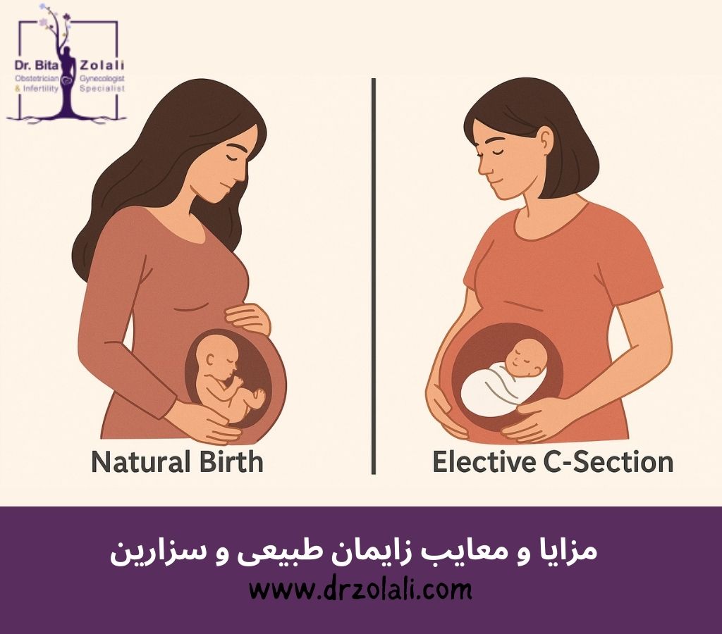 مزایا و معایب زایمان طبیعی و سزارین – دکتر بیتا زلالی مزایا و معایب زایمان طبیعی و سزارین - دکتر بیتا زلالی